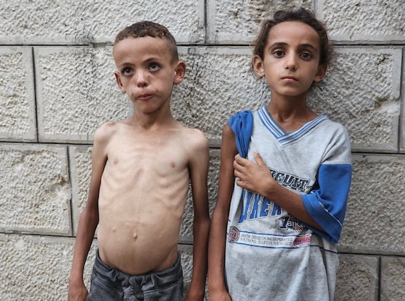 Fuentes: La Jornada - Imagen: Mohammed, siete años, y Zeina, 10. Su madre dice que "están silenciando el hambre con agua". Foto: Seham Tantesh/The Guardian